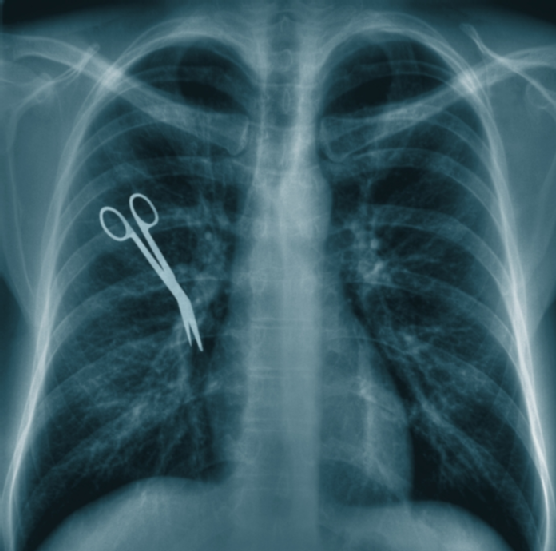 Chest X-Ray